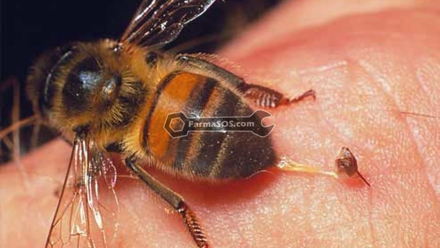 زنبور گزیدگی گزیدن در حشرات